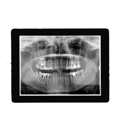 Panoramic and cephalometric X-ray used for orthodontic diagnosis